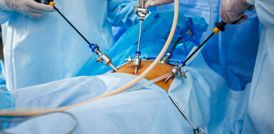 Laparoscopic Surgery
